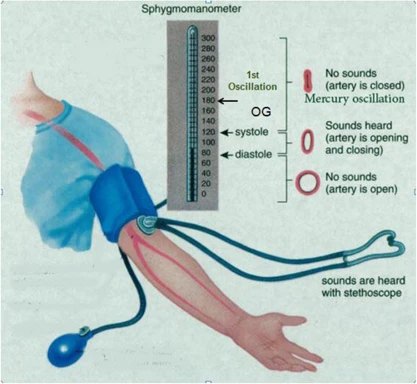 Repeat Bp Sign Experiment 14: Determination of Blood Pressure